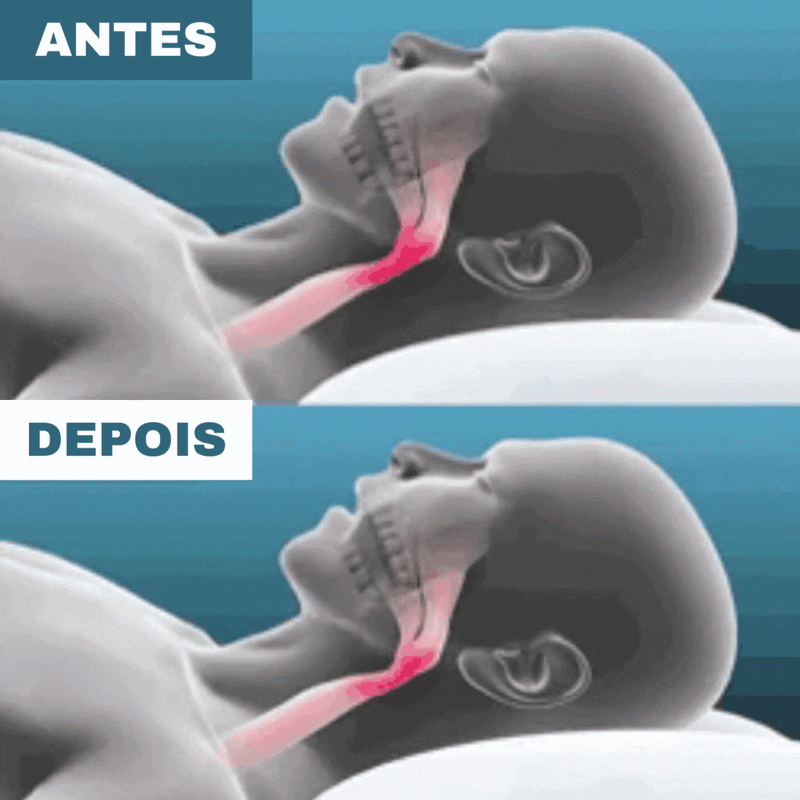 Antes e depois Znorex